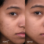 Sérum Visage 5 en 1 : Hyaluronique, Nicotinamide, Vitamine C et E & Collagène