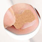 Patchs Correcteurs d'Ongles Incarnés